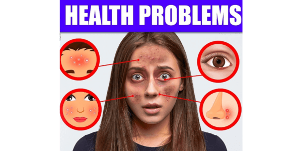 Clues Your Face Gives About Your Health